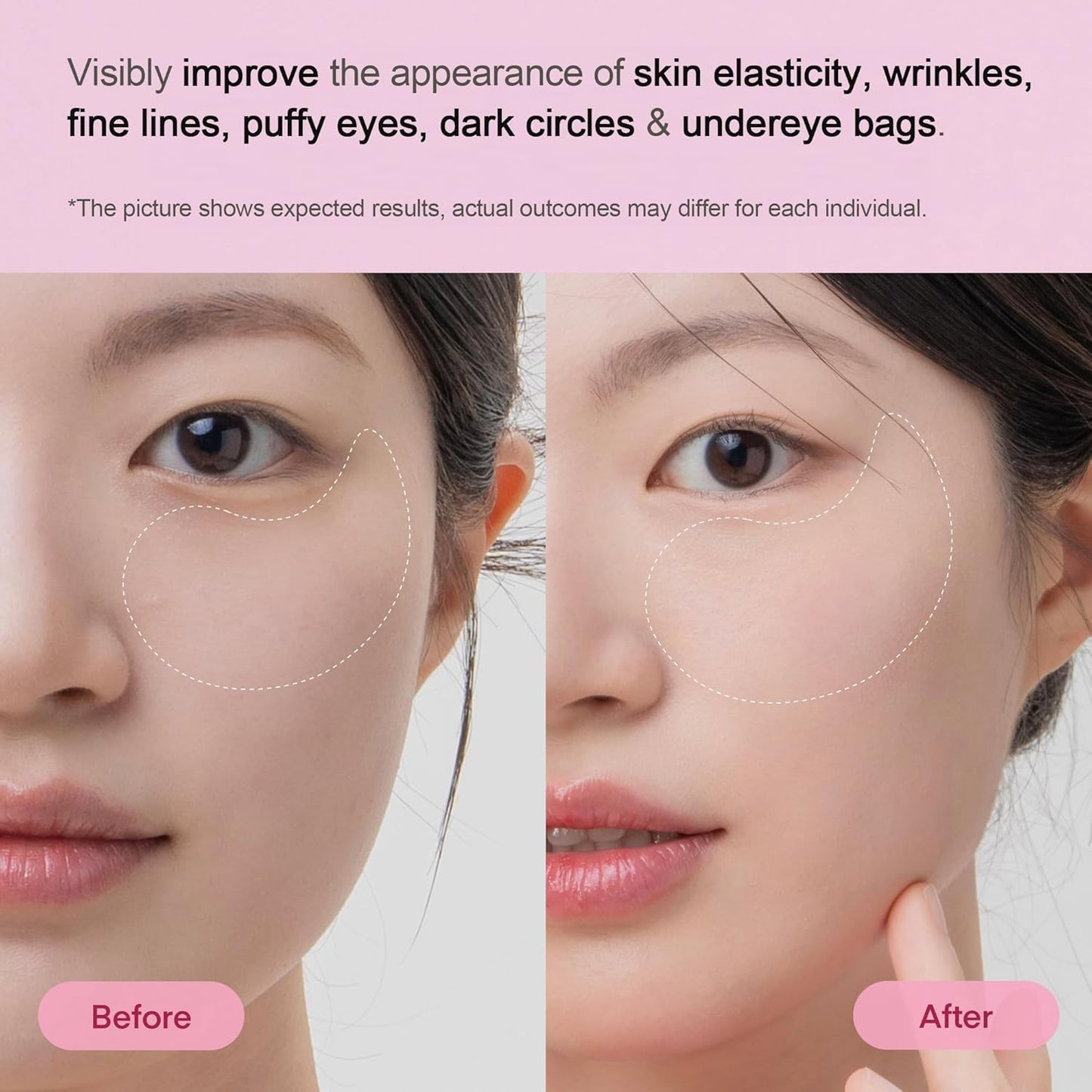 Novaskiny™ Collagen Multi-Peptide Eye Gel Patch