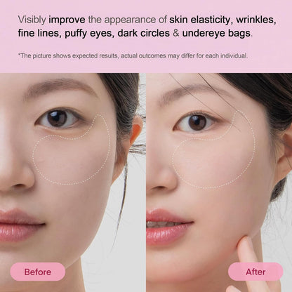 Novaskiny™ Collagen Multi-Peptide Eye Gel Patch